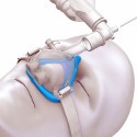 Image - Engineer's Toolbox: <br>Medical mask poses special overmolding challenges