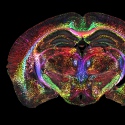 Image - Brain images get 64 million times sharper